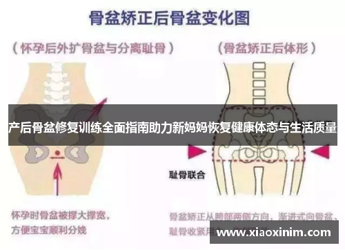 产后骨盆修复训练全面指南助力新妈妈恢复健康体态与生活质量